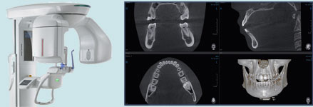 PaX-Duo3D PLUS Cone Beam CAT Scan